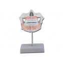 MODELLO DENTATURA PERMANENTE